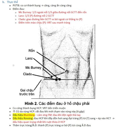 [Ngoại] Viêm ruột thừa – Vẽ bậy Y học